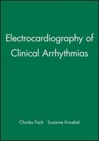Clinical Electrocardiography of Arrhythmias