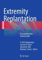 Extremity Replantation