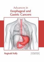 Advances in Esophageal and Gastric Cancers