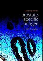 Clinical Guide to Prostate-Specific Antigen
