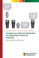 Tensões ao redor de implantes em diferentes níveis de inserção
