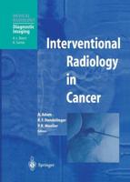 Interventional Radiology in Cancer. Diagnostic Imaging